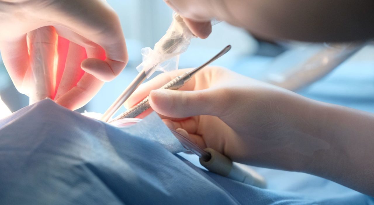 Chirurgia orale per ottavi inclusi Studio dentistico Petreni Bianciardi