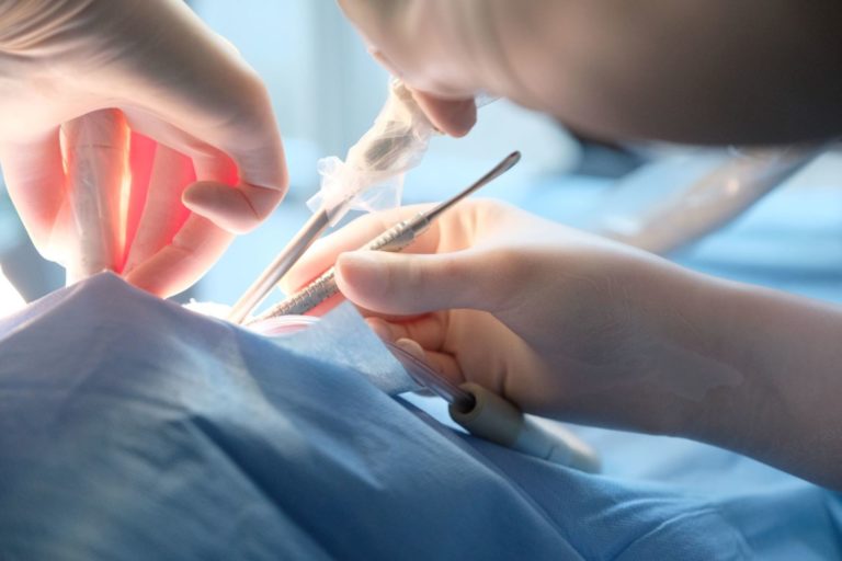 Chirurgia orale per ottavi inclusi Studio dentistico Petreni Bianciardi