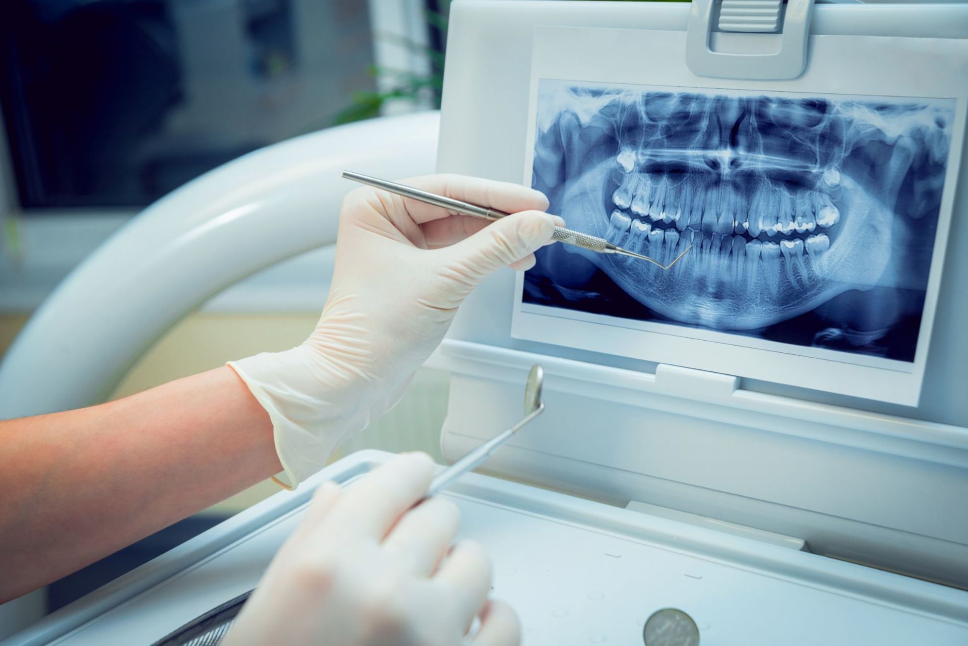 Studio Dentistico Grosseto e una radiografia di una bocca