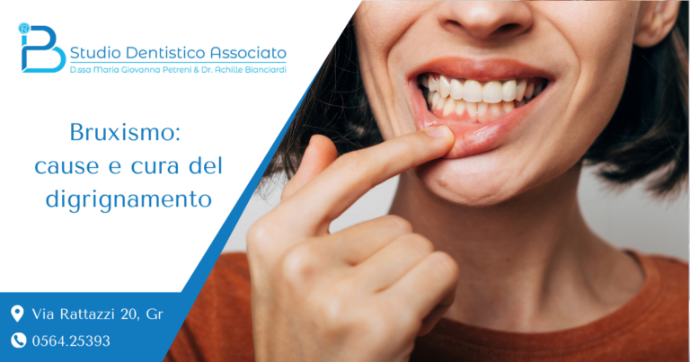 Bruxismo Cause e cura del digrignamento - Studio Dentistico Petreni Bianciardi