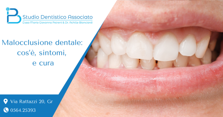 Malocclusione dentale, cos'è sintomi e cura - Studio petreni bianciardi