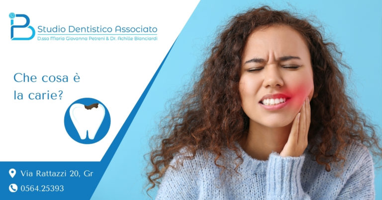 Che cosa è la carie - Clinica Odontoiatrica Grosseto