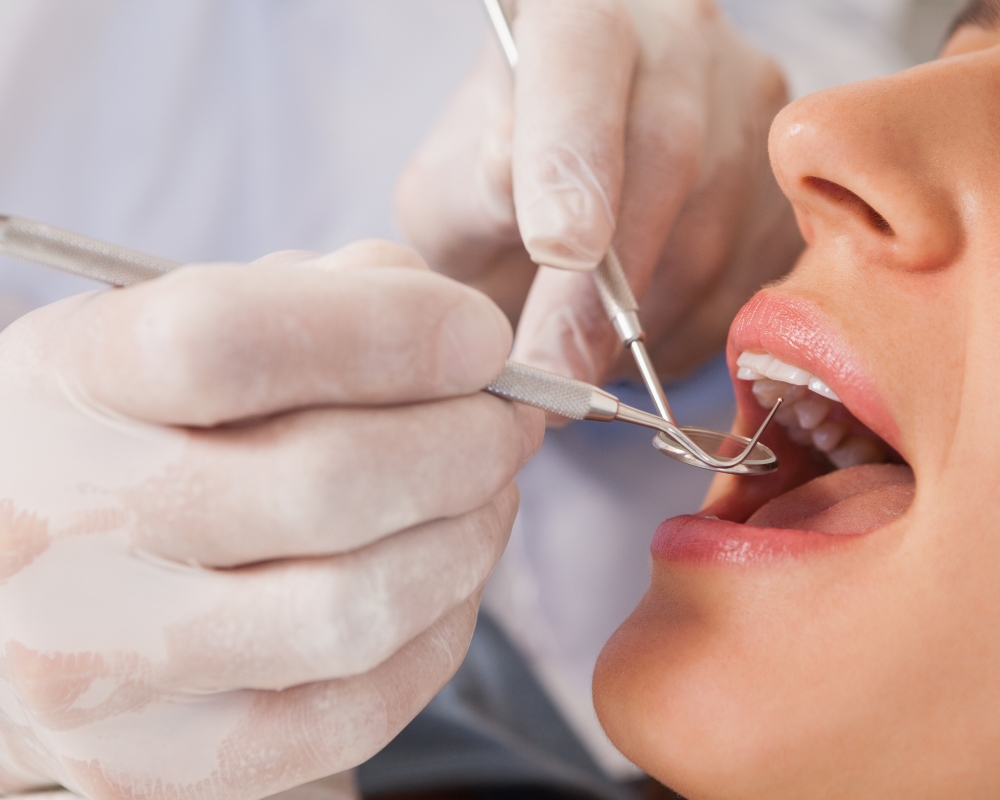 Macchie dentali a cosa sono dovute - Clinica Odontoiatrica a Grosseto Petreni Bianciardi