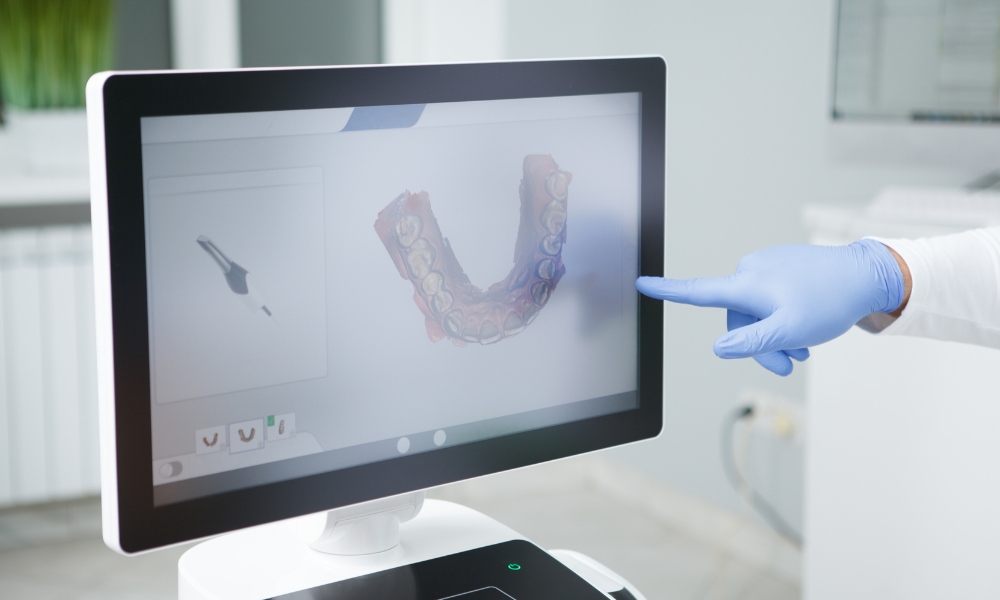 I vantaggi delle impronte digitali - Centro dentistico Grosseto Petreni Bianciardi