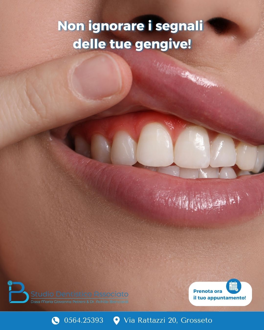 Dentista parodontite Grosseto guida completa Studio Petreni Bianciardi