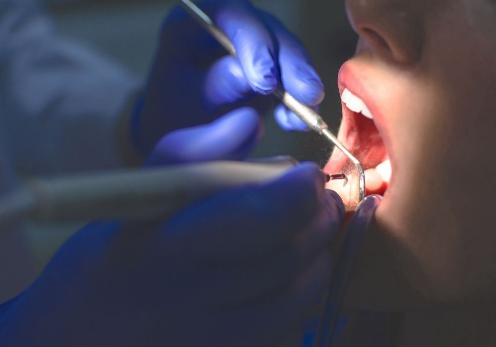 Studio Dentistico Petreni Bianciardi per Parodontite Sintomi Cause e cure