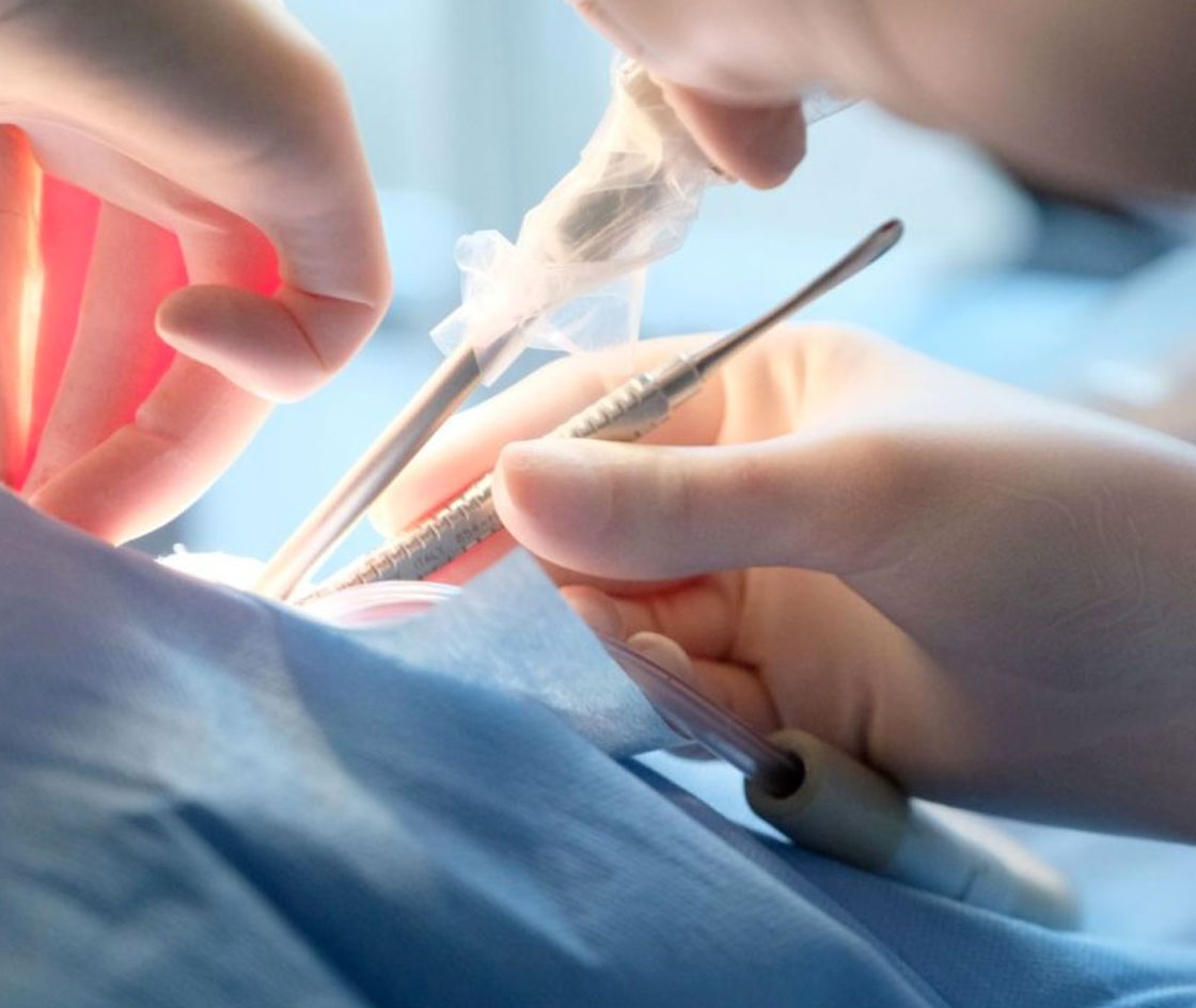 Chirurgia-orale-per-ottavi-inclusi-Studio-dentistico-Petreni-Bianciardi-1280x700