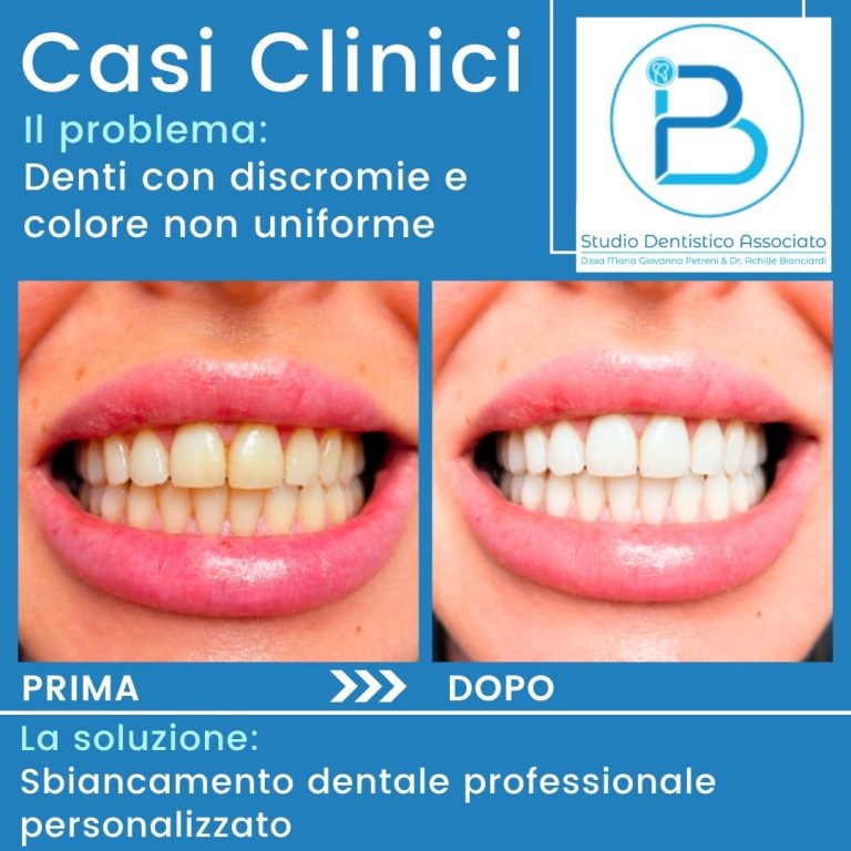Sbiancamento Dentale Professionale Grosseto Petreni Bianciardi