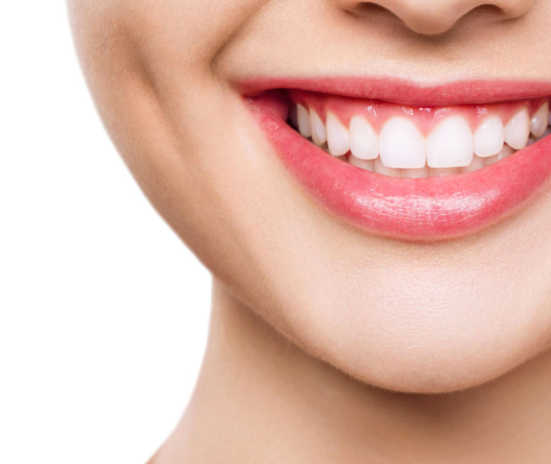 Sbiancamento-dentale-Grosseto-un-sorriso-splendente-1280x700