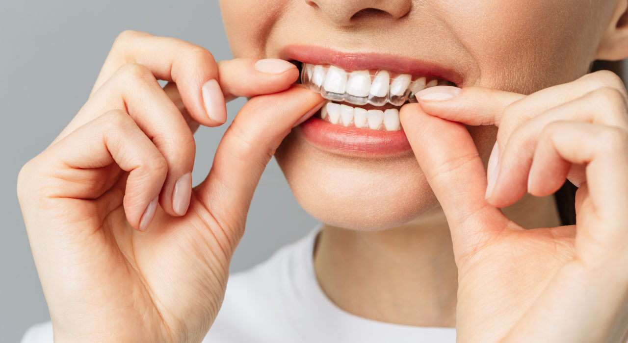 ortodonzia-grosseto-ortodonzia-conservativa-ed-estetica-ortodonzia-pediatrica-grosseto-studio-dentistico-petreni-bianciardi-1280x700