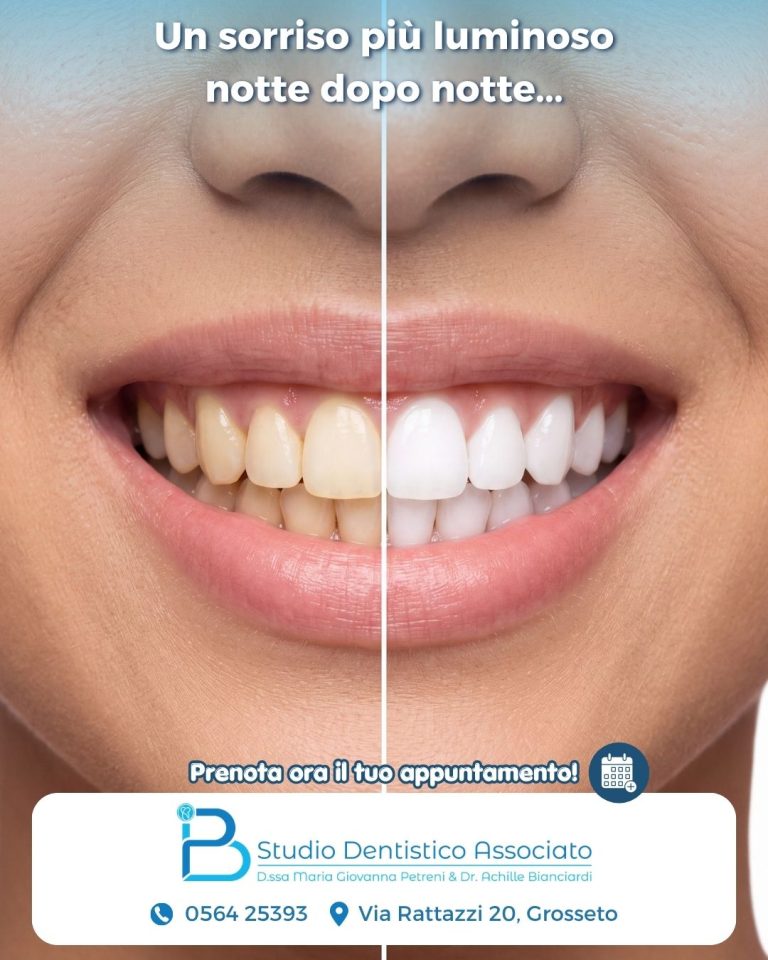 Sbiancamento Dentale Grosseto notturno - Studio dentitico Petreni Bianciardi